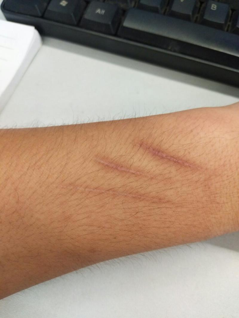 畫傷疤教程圖片教程