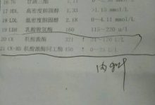 肌酸激酶高是怎么回事-肌酸激酶高是什么原因引起的-大智網匯