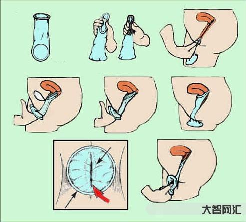 如何正確使用避孕套