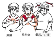 冠心病的癥狀表現(xiàn)在哪些方面-冠心病有什么特征癥狀?-大智網(wǎng)匯