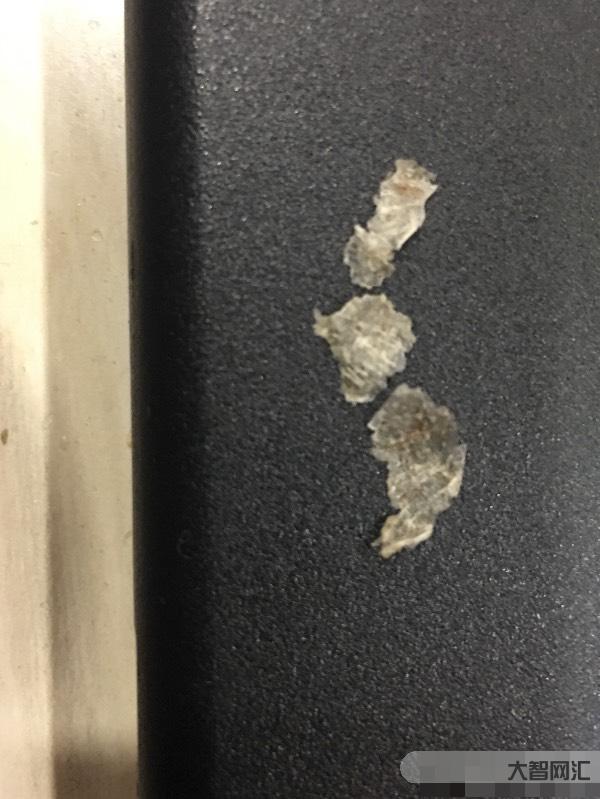 頭皮屑多是什么原因