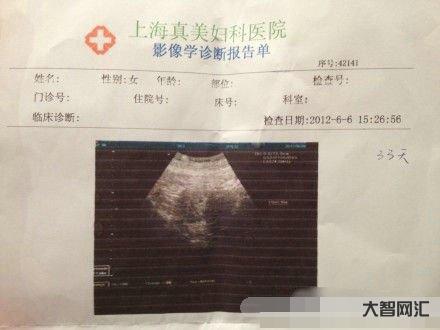 1、懷孕一個月內如何打胎?