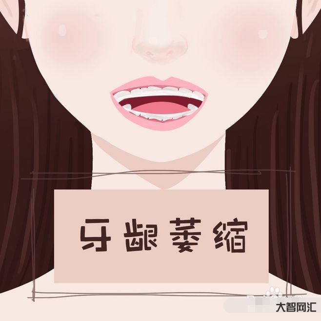 2、如何修復牙齦萎縮?