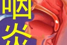 咽炎的癥狀有哪些癥狀-患上咽喉炎后,身體都會有什么癥狀?-大智網匯