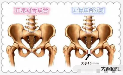 2、膀胱和前列腺在人體的那個部位。在肚臍的右邊嗎？