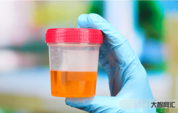 血脂跟血肌酐一樣嗎-血肌酐高了不要怕，這5個(gè)指標(biāo)尚可的腎病也可以與尿毒