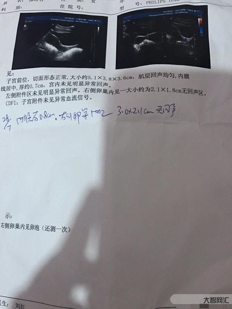 2、子宮內膜多厚正常