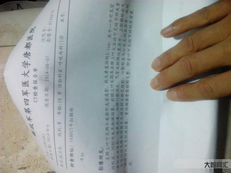 咳嗽半年才知肺中有蝦殼-84歲老人吃排骨嗆到氣管里,出現咯血 咳嗽半年才知肺中有蝦殼-84歲老人吃排骨嗆到氣管里,出現咯血