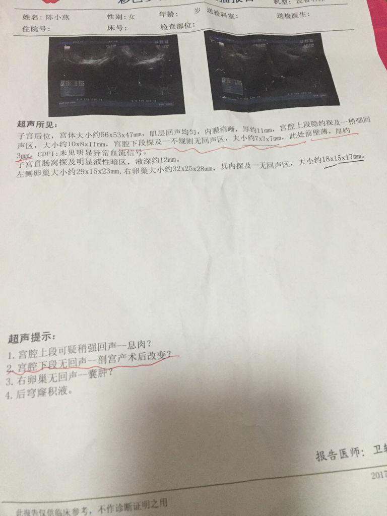 積水多久能排干凈啊-廣東韶關多鎮出現強降雨，有村里積水深達1米，轉移上
