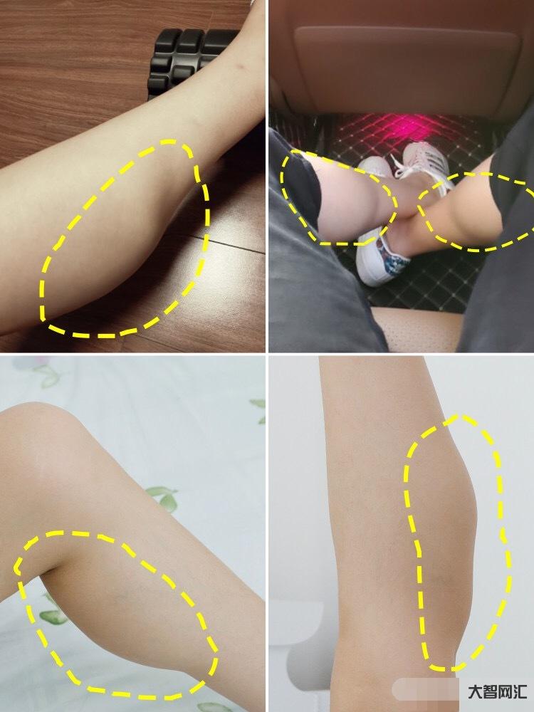 為什么腿的肌肉好緊繃繃的-我是因為胯大才腿粗?今天才知道減掉粗大腿得先