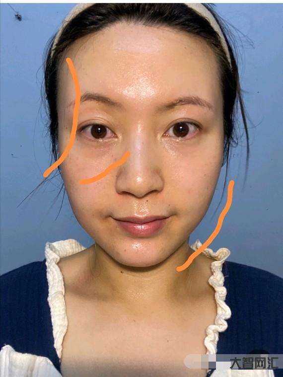 下巴上突然有凹陷-面中部凹陷、下巴很長，像朱元璋這種“豬腰子臉”還能拯