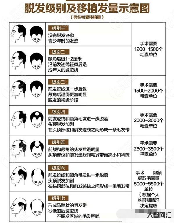 植發(fā)要多少錢一般-印度男子植發(fā)，把命搭進去?為一頭秀發(fā)，窮人只能去黑診