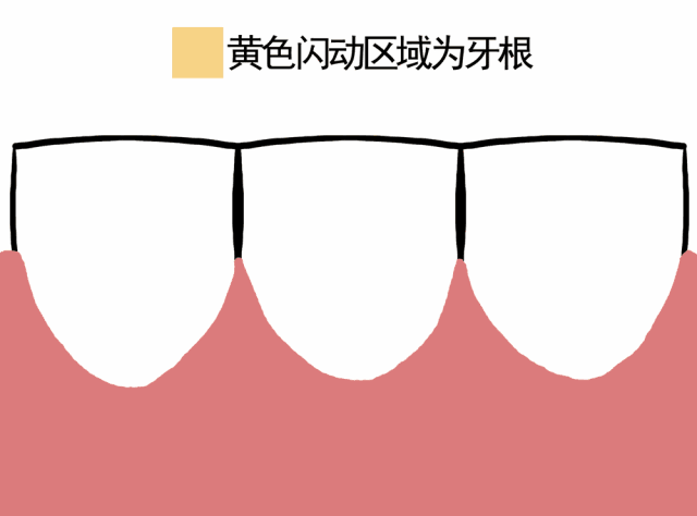 牙齦萎縮怎么恢復(fù)-牙齦萎縮該怎么辦呢? 牙齦萎縮怎么恢復(fù)-牙齦萎縮該怎么辦呢?