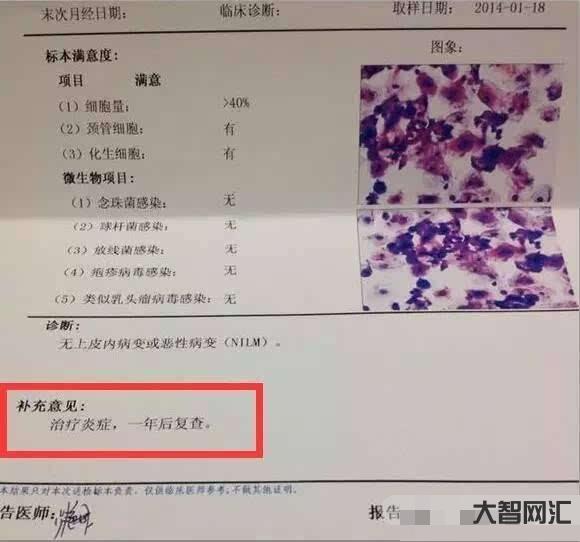 tct檢查什么項(xiàng)目-宮頸炎應(yīng)該做什么檢查