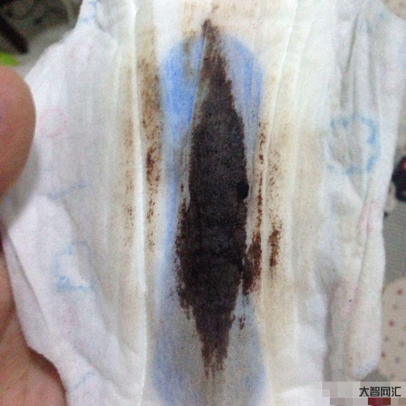 月經量少顏色黑褐色是什么原因-月經發黑量少怎么調理?