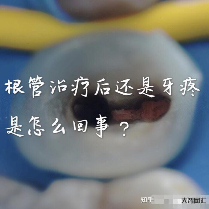 根管治療多少錢一顆牙-為啥根管治療這么貴，是不是被坑了?