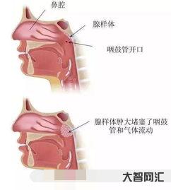 給大家科普下6歲小孩老是清嗓子吭吭的如何辦，孩子不停的清嗓子叫什么原因