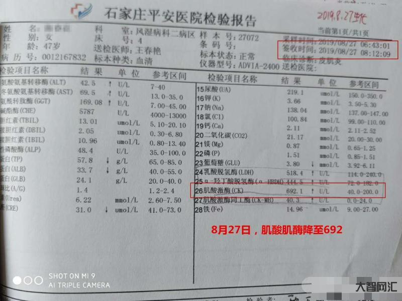肌酸激酶高是怎么回事-查出“肌酸激酶”高,可能暗示這些問題,要注意及時 肌酸激酶高是怎么回事-查出“肌酸激酶”高,可能暗示這些問題,要注意及時