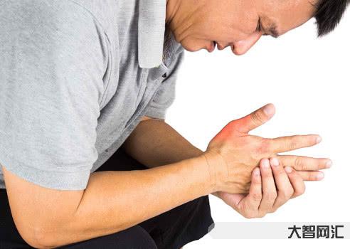痛風(fēng)會在哪些部位痛-痛風(fēng)可不僅是關(guān)節(jié)痛，背后的這個問題別大意