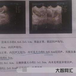 盆腔積液的原因，盆腔積液是炎癥嗎