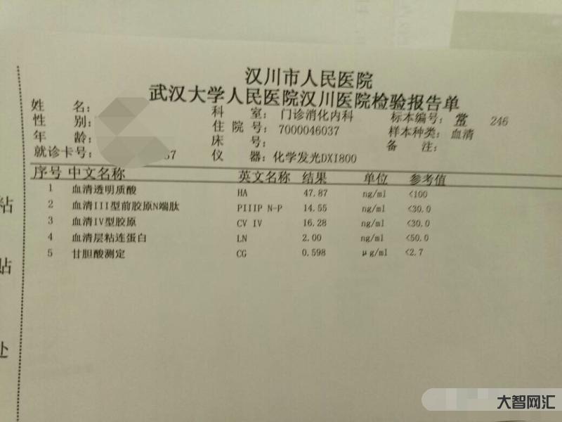肝功能檢查主要看哪幾項指標-肝功能化驗單怎么看?這3個指標記住，不用問