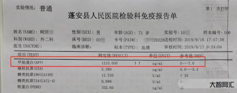 甲胎蛋白偏高說明什么問題-甲胎蛋白升高不一定是肝癌!但很可能有這幾種情