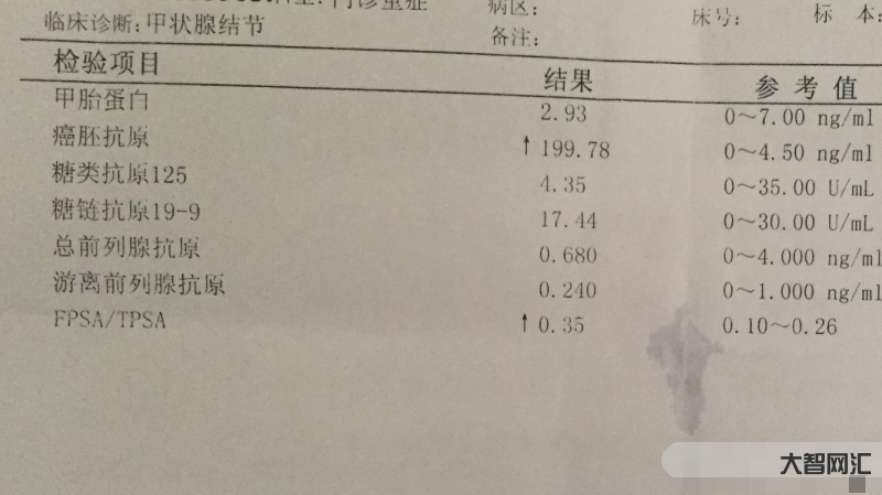 癌胚抗原偏高說明什么-腫瘤標志物升高就代表患癌嗎?發現腫瘤標志物升高時