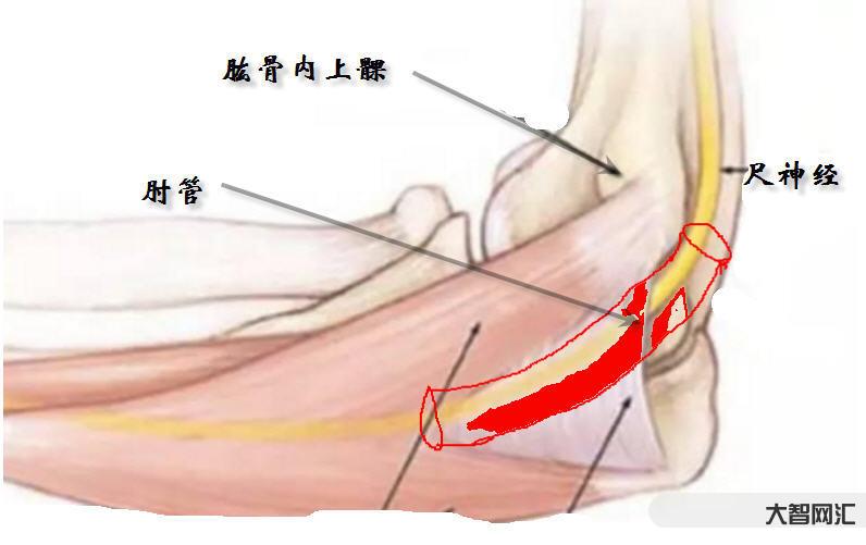 雷特綜合癥是什么癥狀-運動訓練或可減輕罕見病雷特綜合征癥狀 雷特綜合癥是什么癥狀-運動訓練或可減輕罕見病雷特綜合征癥狀